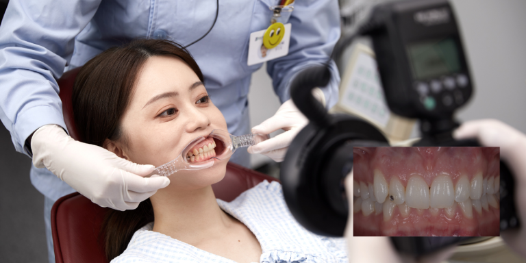 Los flashes perfectos para fotografía dental